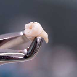 An extracted tooth in Arlington