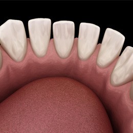model of gapped teeth