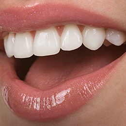 An up-close view of a person’s smile that has undergone teeth whitening